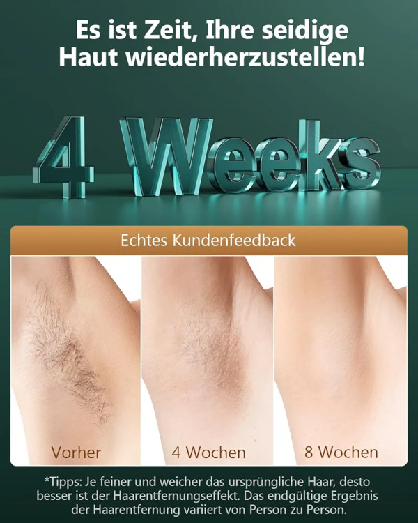 لیزر موهای زائد LUBEX D-1196B مدل | IPL خانگی با شات نامحدود و سرعت بالا